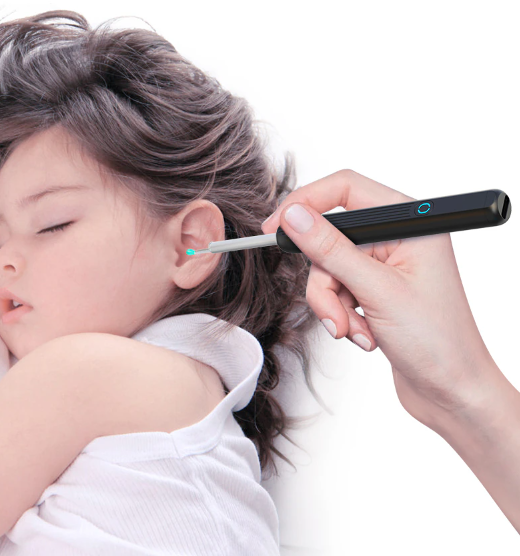 EarWax Vision: Clear Ear Hygiene