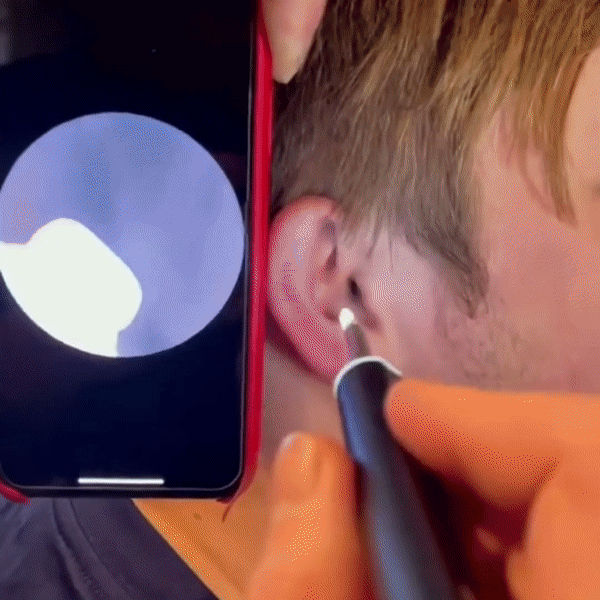 EarWax Vision: Clear Ear Hygiene