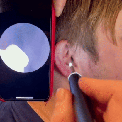EarWax Vision: Clear Ear Hygiene